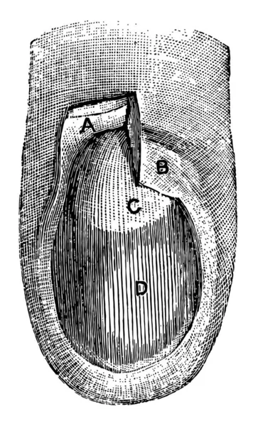 Cette Illustration Représente Ongle Position Dessin Ligne Vintage Illustration Gravure — Image vectorielle