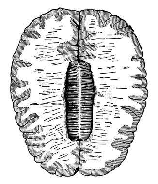 The outer shaded part is the gray matter and the inner lighter area is the white matter, vintage line drawing or engraving illustration. clipart