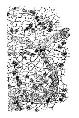Bu resimde bir lenf bezi, vintage çizgi çizme veya oyma illüstrasyon bağ dokusu gösterir.