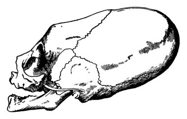 Bu resimde bozuk kafatası, çocuk, vintage çizgi çizme veya oyma illüstrasyon temsil eder..
