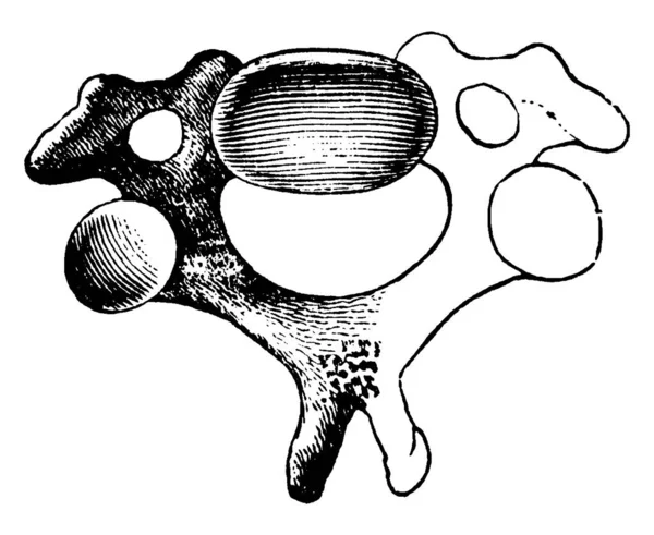 Esta Ilustración Representa Una Vértebra Cervical Dibujo Línea Vintage Ilustración — Vector de stock