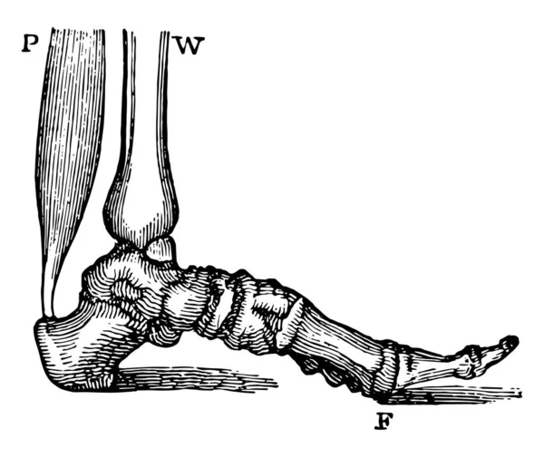 这个插图代表脚跟肌肉 复古线条画或雕刻插图 — 图库矢量图片