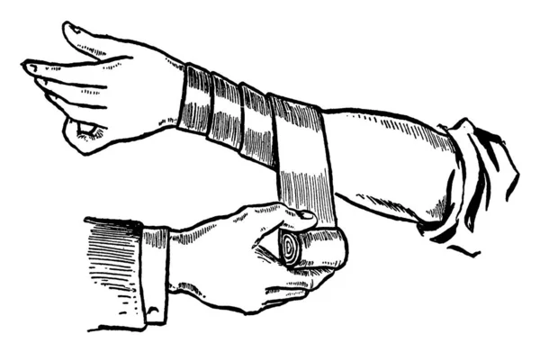Zetten Een Spiraal Bandage Worden Gebruikt Eerste Hulp Vintage Lijntekening — Stockvector
