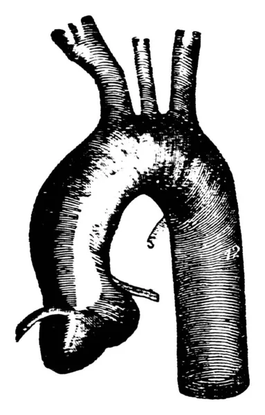 Questo Diagramma Rappresenta Aorta Toracica Disegno Linee Vintage Incisione Illustrazione — Vettoriale Stock
