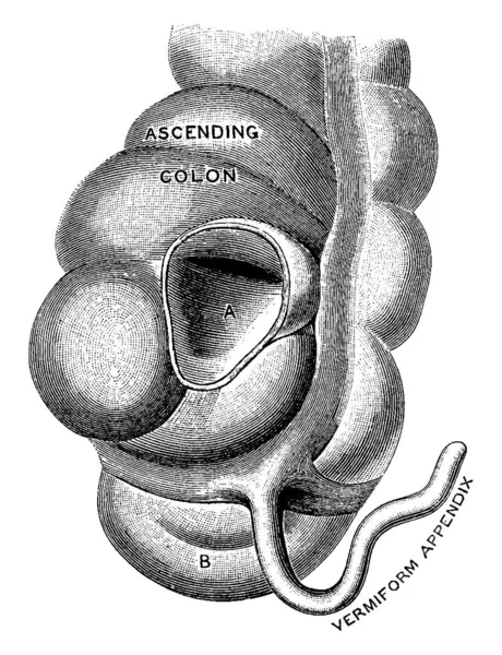 Apéndice vermiforme Imágenes Vectoriales, Gráfico Vectorial de Apéndice