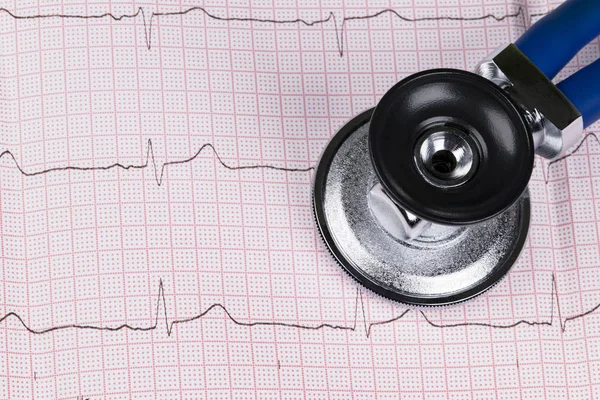 Stethoscope on the electrocardiogram (ECG) graph.Medicine concept. healthcare background — Stock Photo, Image