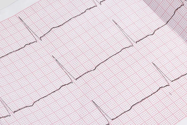 Close up of an electrocardiogram in paper form, medical healthcare — Stock Photo, Image