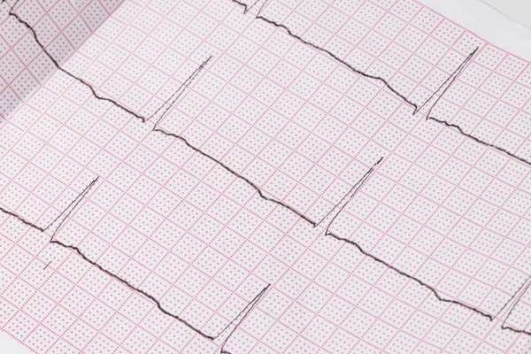 Close Electrocardiogram Paper Form Medical Healthcare — Stock Photo, Image