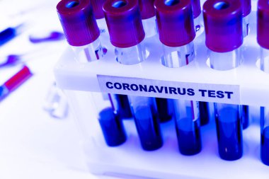 Coronavirus kan testi konsepti. Coronavirus testi için test tüpündeki kan örneğini analiz ediyorum. 2019 ncov analizi için kan testi tüpü. Coronavirus kan analizi konsepti. 