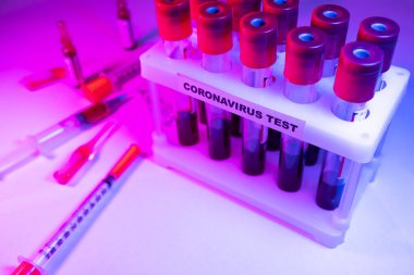 Coronavirus kan testi konsepti. Coronavirus testi için test tüpündeki kan örneğini analiz ediyorum. 2019 ncov analizi için kan testi tüpü. Coronavirus kan analizi konsepti.