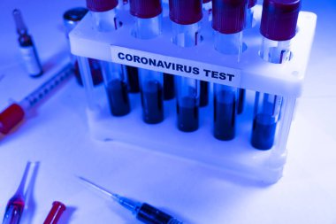 Coronavirus kan testi konsepti. Coronavirus testi için test tüpündeki kan örneğini analiz ediyorum. 2019 ncov analizi için kan testi tüpü. Coronavirus kan analizi konsepti.