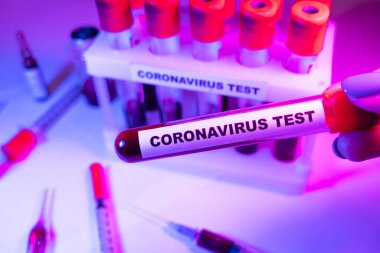 Coronavirus kan testi konsepti. Coronavirus testi için test tüpündeki kan örneğini analiz ediyorum. 2019 ncov analizi için kan testi tüpü. Coronavirus kan analizi konsepti.