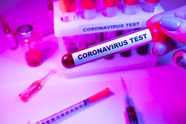 Coronavirus kan testi konsepti. Coronavirus testi için test tüpündeki kan örneğini analiz ediyorum. 2019 ncov analizi için kan testi tüpü. Coronavirus kan analizi konsepti.