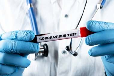 Coronavirus kan testi konsepti. Doktor elinde Coronavirus testi için test tüpündeki kan örneğini analiz ediyorum. 2019 ncov analizi için kan testi tüpü. Coronavirus kan analizi konsepti.