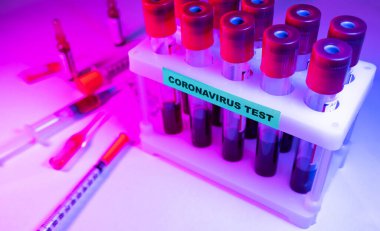 Coronavirus kan testi konsepti. Coronavirus testi için test tüpündeki kan örneğini analiz ediyorum. 2019 ncov analizi için kan testi tüpü. Coronavirus kan analizi konsepti.