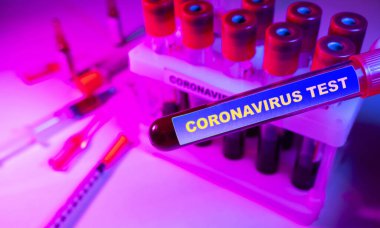 Coronavirus kan testi konsepti. Coronavirus testi için test tüpündeki kan örneğini analiz ediyorum. 2019 ncov analizi için kan testi tüpü. Coronavirus kan analizi konsepti.