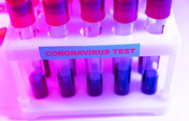Coronavirus kan testi konsepti. Coronavirus testi için test tüpündeki kan örneğini analiz ediyorum. 2019 ncov analizi için kan testi tüpü. Coronavirus kan analizi konsepti.