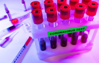 Coronavirus kan testi konsepti. Coronavirus testi için test tüpündeki kan örneğini analiz ediyorum. 2019 ncov analizi için kan testi tüpü. Coronavirus kan analizi konsepti.