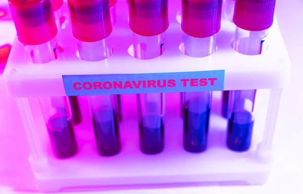 แนวค ดการตรวจเล อดของไวร สโคโรนา เคราะห วอย างเล อดในท อทดสอบส าหร — ภาพถ่ายสต็อก