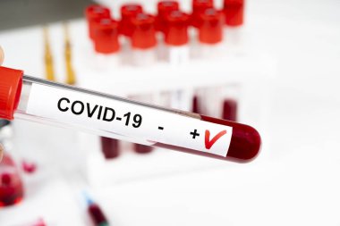 Pozitif koronavirüs kan testi konsepti. Coronavirus testi için test tüpündeki kan örneğini analiz ediyorum. 2019 nCoV ya da COVID-19 testi için kan dolu tüp. Coronavirus kan analizi konsepti.