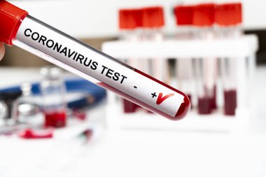 Pozitif koronavirüs kan testi konsepti. Coronavirus testi için test tüpündeki kan örneğini analiz ediyorum. 2019 nCoV ya da COVID-19 testi için kan dolu tüp. Coronavirus kan analizi konsepti.