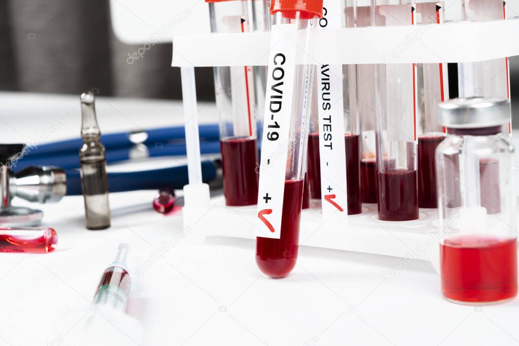 Positive coronavirus blood test concept. Analyzing blood sample in test tube for coronavirus test. Tube with blood for 2019-nCoV or COVID-19 test. Coronavirus blood analysis concept.
