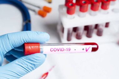 Pozitif koronavirüs kan testi konsepti. Doktor elinde Coronavirus testi için test tüpündeki kan örneğini analiz ediyorum. 2019 nCoV ya da COVID-19 testi için kan dolu tüp. Coronavirus kan analizi konsepti.