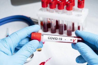 Pozitif koronavirüs kan testi konsepti. Doktor elinde Coronavirus testi için test tüpündeki kan örneğini analiz ediyorum. 2019 nCoV ya da COVID-19 testi için kan dolu tüp. Coronavirus kan analizi konsepti.