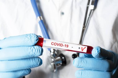 Pozitif koronavirüs kan testi konsepti. Doktor elinde Coronavirus testi için test tüpündeki kan örneğini analiz ediyorum. 2019 nCoV ya da COVID-19 testi için kan dolu tüp. Coronavirus kan analizi konsepti.