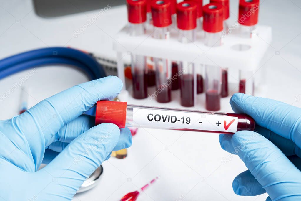 Positive coronavirus blood test concept. Analyzing blood sample in test tube for coronavirus test in doctor hand. Tube with blood for 2019-nCoV or COVID-19 test. Coronavirus blood analysis concept.