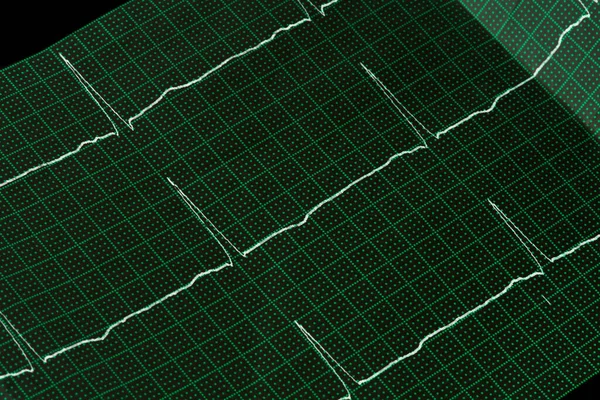 Close Electrocardiogram Paper Form Medical Healthcare Concept Ecg — Stock Photo, Image