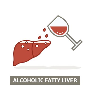 Alkolik yağlı karaciğer