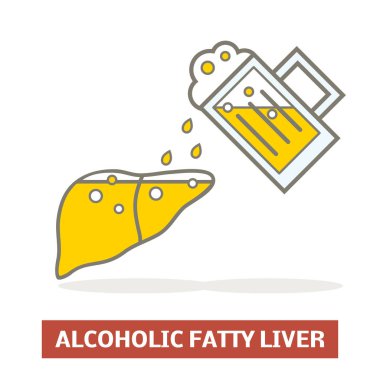 Alkolik yağlı karaciğer