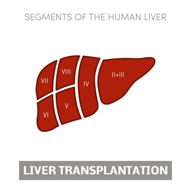 Liver transplantation concept clipart