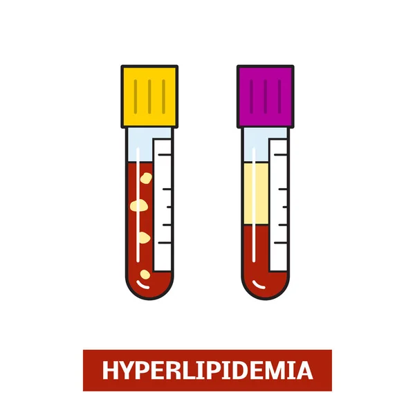 Vacutainers에서 hyperlipidemic 혈액 — 스톡 벡터