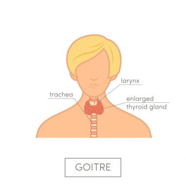 Tiroid bezi erkek anatomisi