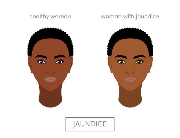 Здоровые и больные азиатки
