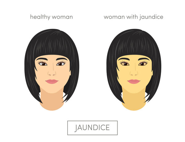 Концепция вектора Желтухи
