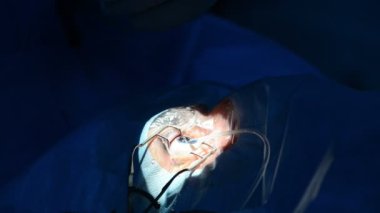 Oftalmik Kliniği, cerrahi