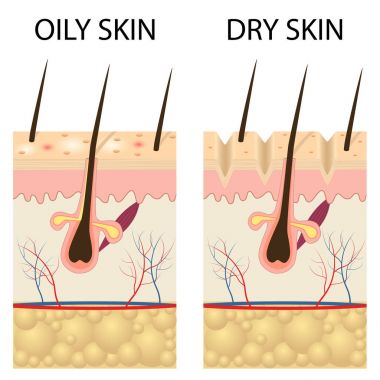 Dry and oily skin. clipart
