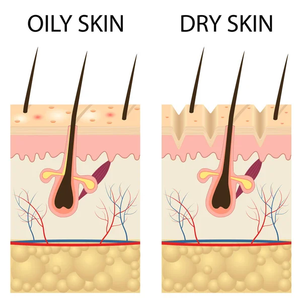 Dry and oily skin. — Stock Vector