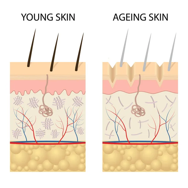 Comparación de piel joven sana y piel vieja . Ilustraciones De Stock Sin Royalties Gratis