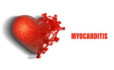 3D render  Concept of healthy and damaged heart by disease called myocarditis or inflammation of the heart muscle caused by Corona virus  Covid-19. Copy space for text, white isolated background.  clipart