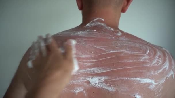 Ręcznie nanosić specjalny lek pantenol na opaloną skórę męską — Wideo stockowe