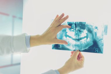 Panoramik diş röntgeni