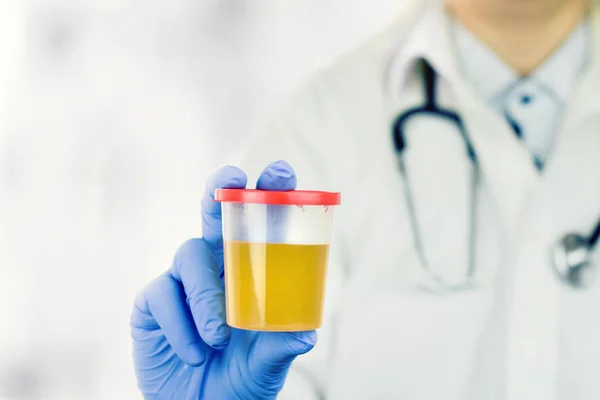Soins de santé et médecine. Test d'urine médicale, gros plan — Photo