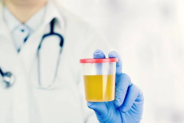 Sanità e Medicina. Test delle urine mediche, primo piano — Foto Stock