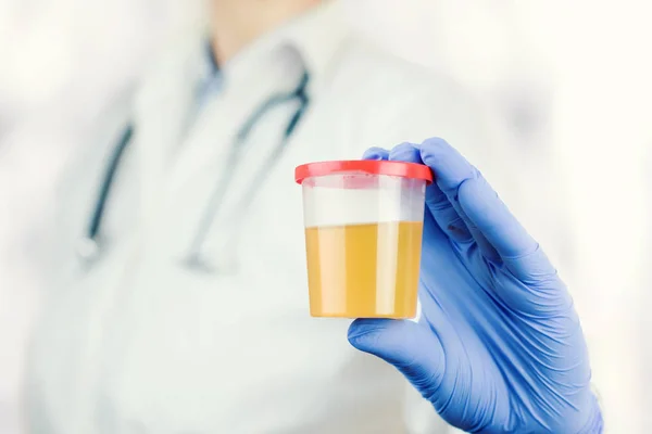 Soins de santé et médecine. Test d'urine médicale, gros plan — Photo