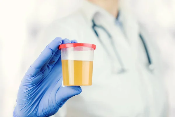 Soins de santé et médecine. Test d'urine médicale, gros plan — Photo