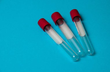 Coronavirus ilaç ve tedavi konsepti. Yeni korona virüsü salgını tespit edildiğinde kan test tüpleri